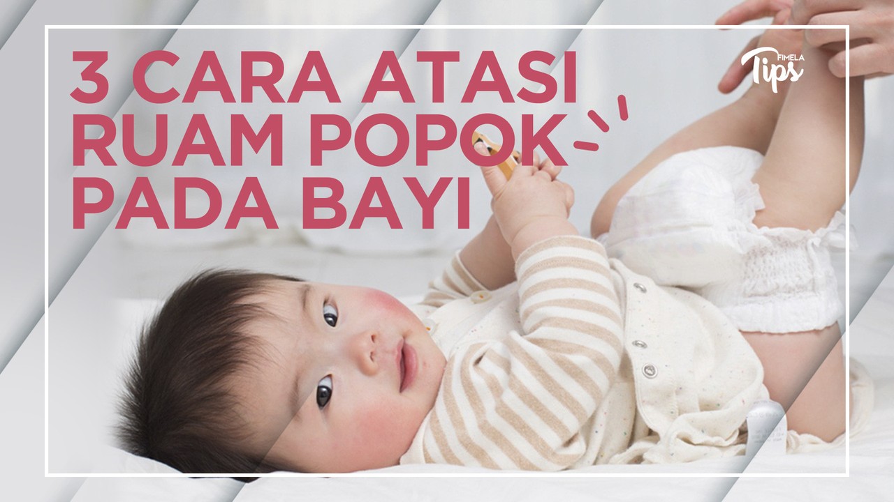 Streaming Cara Ampuh Mengatasi Ruam Popok pada Bayi ...