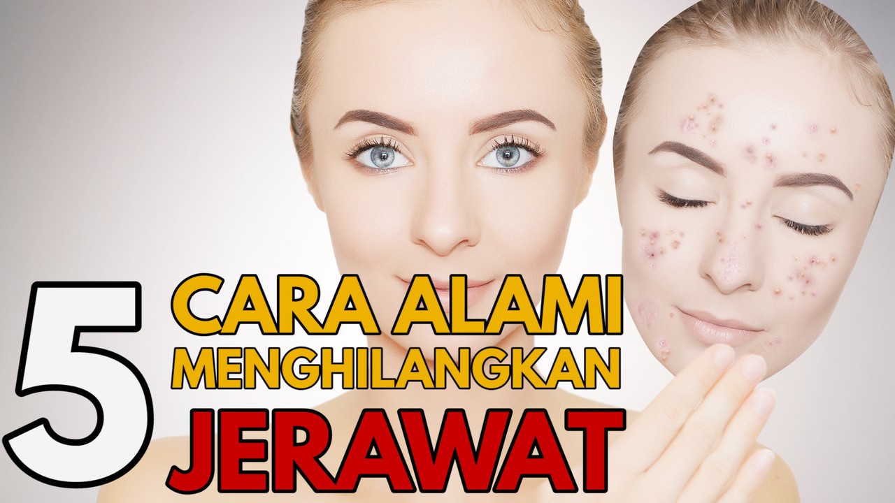 Streaming Bawang Putih Hingga Alpukat, Menghilangkan Jerawat dengan